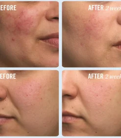 Ultra Repair Cream Intense Repair - 170 ml